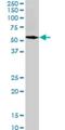 Spastin antibody, H00006683-M02, Novus Biologicals, Western Blot image 