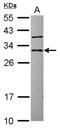 Copper homeostasis protein cutC homolog antibody, NBP2-16038, Novus Biologicals, Western Blot image 