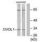 Ovo Like Transcriptional Repressor 1 antibody, A11495, Boster Biological Technology, Western Blot image 