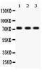 Tumor Protein P73 antibody, LS-C344087, Lifespan Biosciences, Western Blot image 