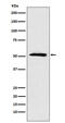 ETS Variant 6 antibody, M00361, Boster Biological Technology, Western Blot image 
