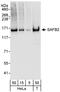 Scaffold Attachment Factor B2 antibody, A301-111A, Bethyl Labs, Western Blot image 