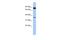 Coiled-Coil Serine Rich Protein 1 antibody, A16702, Boster Biological Technology, Western Blot image 