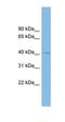 N-Myc Downstream Regulated 1 antibody, orb330523, Biorbyt, Western Blot image 