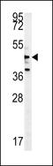 Serine/threonine-protein kinase NLK antibody, 62-978, ProSci, Western Blot image 