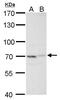 Tumor necrosis factor alpha-induced protein 2 antibody, PA5-34708, Invitrogen Antibodies, Western Blot image 