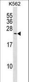 Myosin light chain 6B antibody, LS-C158344, Lifespan Biosciences, Western Blot image 