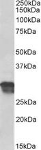 Cyclin D1 antibody, TA329665, Origene, Western Blot image 