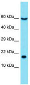 Eukaryotic Translation Initiation Factor 5A antibody, TA335857, Origene, Western Blot image 