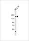 SOS Ras/Rac Guanine Nucleotide Exchange Factor 1 antibody, 63-747, ProSci, Western Blot image 