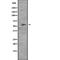 Cyclin Dependent Kinase 8 antibody, abx146743, Abbexa, Western Blot image 