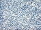 Crystallin Alpha B antibody, GTX84659, GeneTex, Immunohistochemistry paraffin image 