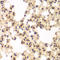 Casein Kinase 2 Alpha 1 antibody, LS-C331589, Lifespan Biosciences, Immunohistochemistry paraffin image 