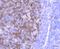 Thymidine Kinase 1 antibody, NBP2-67199, Novus Biologicals, Immunohistochemistry paraffin image 