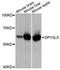 Dihydropyrimidinase Like 5 antibody, A10734, ABclonal Technology, Western Blot image 