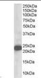 Stathmin 2 antibody, orb88804, Biorbyt, Western Blot image 