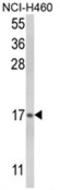 Leukotriene C4 Synthase antibody, AP18104PU-N, Origene, Western Blot image 