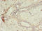 Matrix AAA Peptidase Interacting Protein 1 antibody, LS-C371920, Lifespan Biosciences, Immunohistochemistry paraffin image 