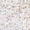 Flap Structure-Specific Endonuclease 1 antibody, NB100-321, Novus Biologicals, Immunohistochemistry paraffin image 