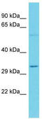 Olfactory Receptor Family 7 Subfamily A Member 5 antibody, TA331895, Origene, Western Blot image 