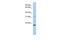 C-Type Lectin Like 1 antibody, PA5-43996, Invitrogen Antibodies, Western Blot image 