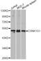Casein Kinase 1 Gamma 1 antibody, LS-C749145, Lifespan Biosciences, Western Blot image 