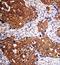 Lactalbumin Alpha antibody, PA1708, Boster Biological Technology, Immunohistochemistry paraffin image 