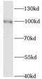 Kinesin Family Member 3C antibody, FNab04564, FineTest, Western Blot image 