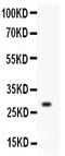 Kallikrein 1 antibody, GTX12293, GeneTex, Western Blot image 