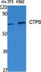 CTP Synthase 1 antibody, A06374, Boster Biological Technology, Western Blot image 