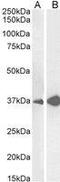 Arginase 1 antibody, GTX89099, GeneTex, Western Blot image 