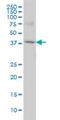 RNA Polymerase I And III Subunit C antibody, H00009533-M05, Novus Biologicals, Western Blot image 