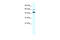 Purinergic Receptor P2X 2 antibody, 28-289, ProSci, Western Blot image 