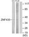 Zinc Finger And SCAN Domain Containing 16 antibody, PA5-38794, Invitrogen Antibodies, Western Blot image 