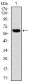 Matrix Metallopeptidase 3 antibody, AM06715PU-N, Origene, Western Blot image 