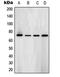 Spleen Associated Tyrosine Kinase antibody, MBS820277, MyBioSource, Western Blot image 
