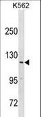 HECT And RLD Domain Containing E3 Ubiquitin Protein Ligase 3 antibody, LS-C157803, Lifespan Biosciences, Western Blot image 