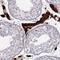 Zinc Finger Protein 433 antibody, HPA073724, Atlas Antibodies, Immunohistochemistry paraffin image 