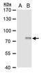 ERCC Excision Repair 2, TFIIH Core Complex Helicase Subunit antibody, PA5-77972, Invitrogen Antibodies, Western Blot image 