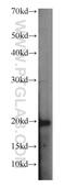 Small Nuclear RNA Activating Complex Polypeptide 5 antibody, 17272-1-AP, Proteintech Group, Western Blot image 