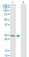 Lysophospholipase 1 antibody, H00010434-M05, Novus Biologicals, Western Blot image 