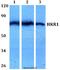 Zinc Finger Protein 875 antibody, A11100-1, Boster Biological Technology, Western Blot image 