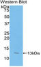 Polymeric Immunoglobulin Receptor antibody, LS-C295998, Lifespan Biosciences, Western Blot image 