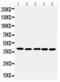 Integrin Subunit Alpha 6 antibody, PA2210, Boster Biological Technology, Western Blot image 