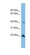 TDP-Glucose 4,6-Dehydratase antibody, NBP1-57733, Novus Biologicals, Western Blot image 