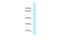 MYCBP Associated And Testis Expressed 1 antibody, A13032, Boster Biological Technology, Western Blot image 