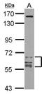 Calcium/Calmodulin Dependent Protein Kinase II Gamma antibody, NBP2-15686, Novus Biologicals, Western Blot image 