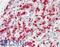 Integrin Subunit Beta 5 antibody, LS-B10667, Lifespan Biosciences, Immunohistochemistry frozen image 