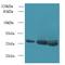 DnaJ Heat Shock Protein Family (Hsp40) Member B8 antibody, MBS1491807, MyBioSource, Western Blot image 