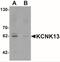 Potassium Two Pore Domain Channel Subfamily K Member 13 antibody, NBP2-41132, Novus Biologicals, Western Blot image 